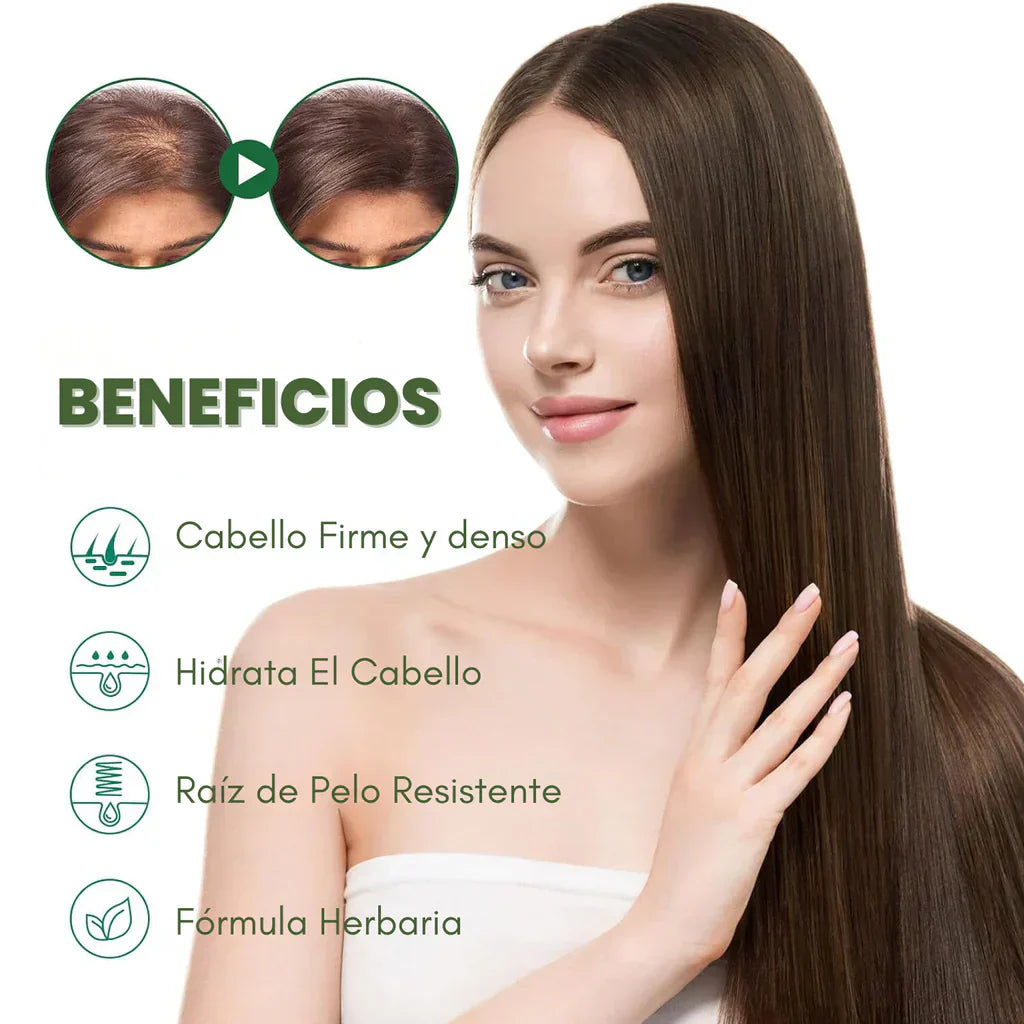 Ouhoe - Tu elixir mágico para el crecimiento del cabello