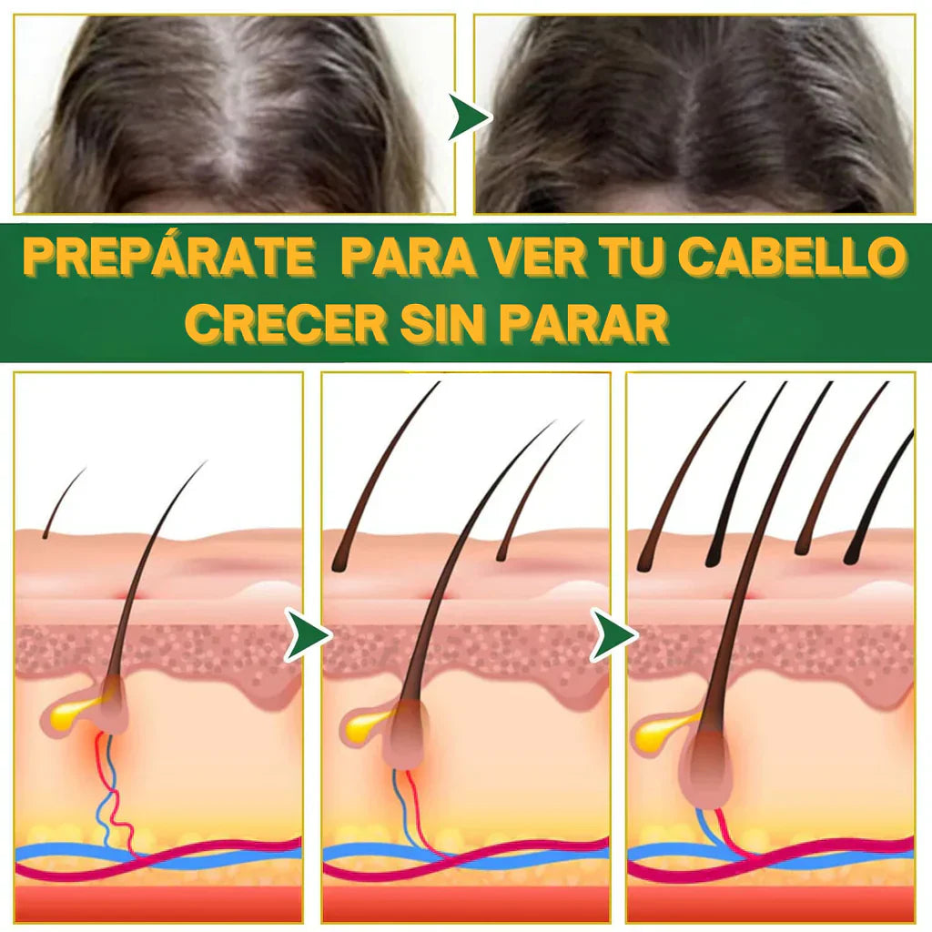 Ouhoe - Tu elixir mágico para el crecimiento del cabello